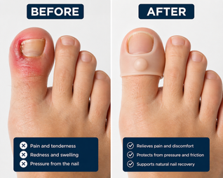 RELUME™ — Walk Pain-Free in 3 Days